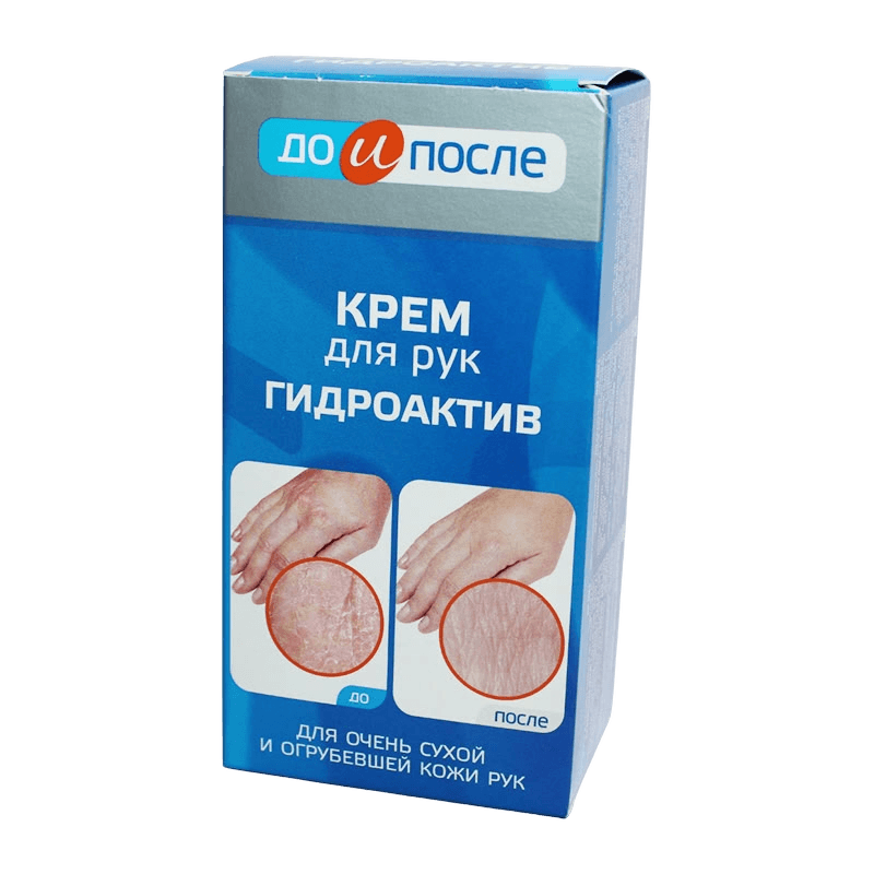 Крем для рук Гидроактив До и После, 100 мл